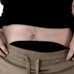 CREMA ANTIESTRÍAS SKINREPAIR