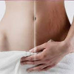 CREMA ANTIESTRÍAS SKINREPAIR